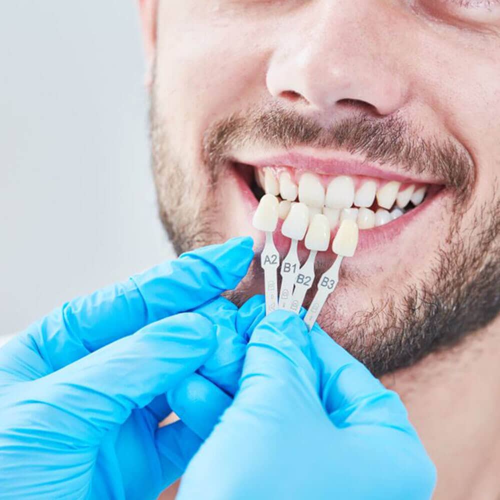 family dentistry kierland dental arts scottsdale az services routine veneers