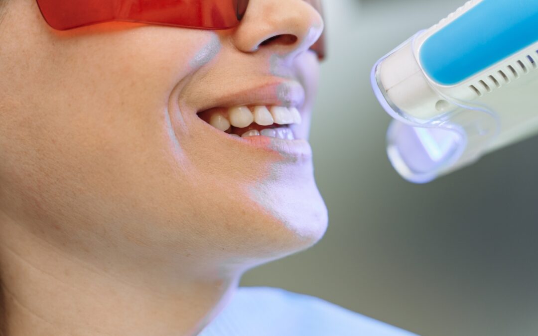 Teeth Whitening in Scottsdale