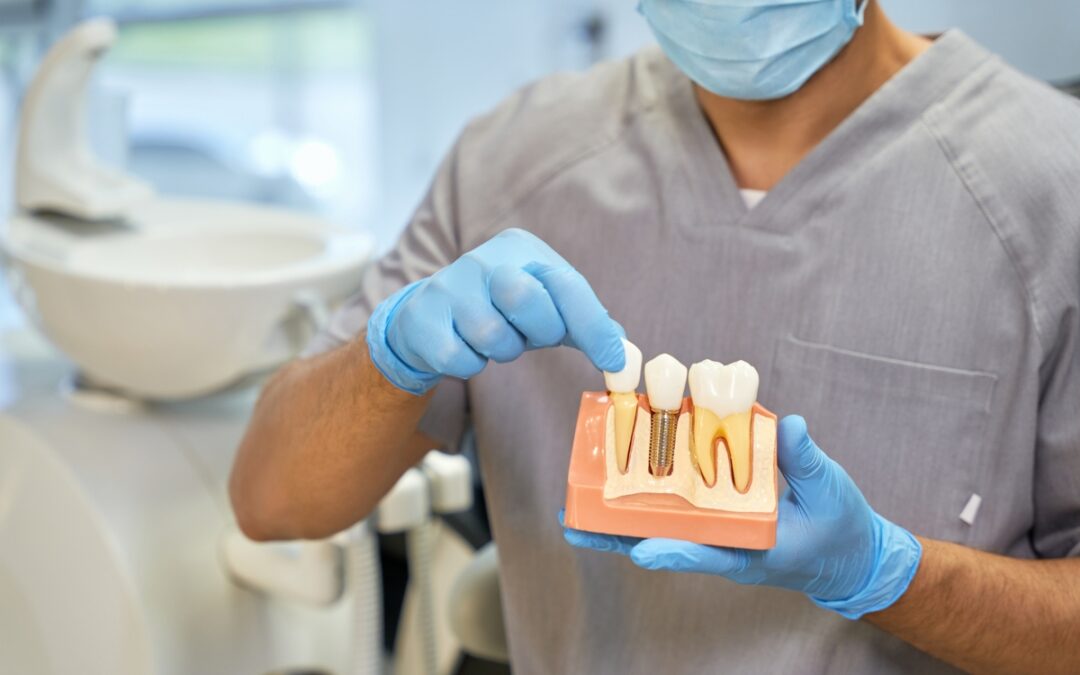 How Dental Implants Restore Confidence And Function For Scottsdale Patients