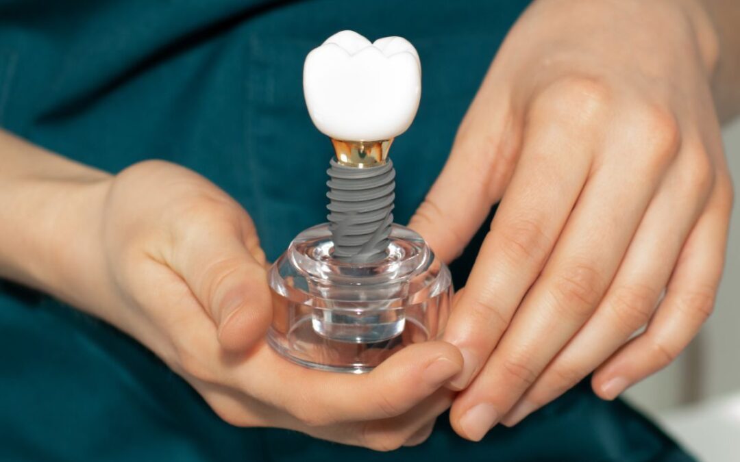 How to Protect Your Dental Implants From Infection