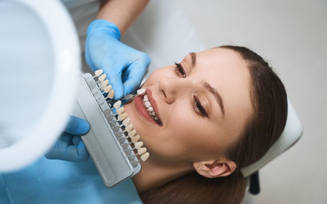 Can Veneers Be Used to Close Small Gaps Between Teeth?