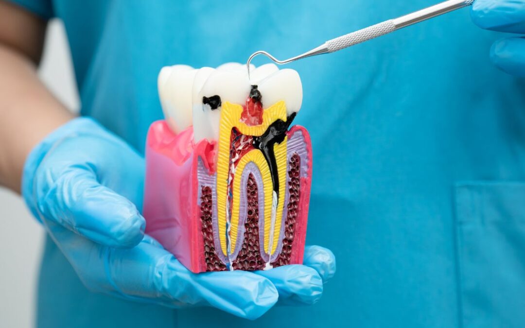 Tooth anatomy model explaining front tooth vs molar root canals