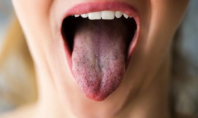 How to Remove Black Spots